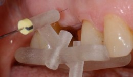 Analytical Methods: Volumetric Measurements 
