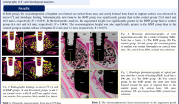 SINUS AUGMENTATION USING RECOMBINANT HUMAN BONE MORPHOGENETIC PROTEIN-2 (rhBMP-2)-LOADED SYNTHETIC BONE SUBSTITUTE WITH SIMULTANEOUS IMPLANT PLACEMENT IN RABBITS