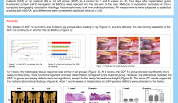 PERIODONTAL REGENERATION VIA CELL HOMING