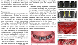 SURGICAL AND PROSTHETIC RESTORATION OF HORIZONTAL RESORBED EDENTULOUS MANDIBLE—A CASE REPORT