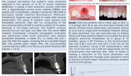 ALVEOLAR DIMENSIONAL VARIATIONS IN ALVEOLAR PRESERVATION AND POST-EXTRACTION IMMEDIATE MAXILLARY IMPLANTS—A 3-D MULTILEVEL MULTIVARIATE PROSPECTIVE STUDY