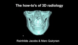 Essentials of 3D radiology