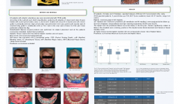 NOBELGUIDE IMPLANT SURGERY AND IMMEDIATE FUNCTION IN FFHB-GRAFTED PATIENTS – A RETROSPECTIVE COHORT STUDY WITH 4–6 YEARS FOLLOW-UP