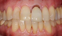 Comprehensive case in a woman