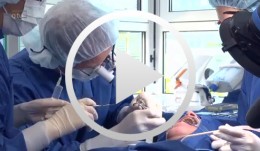 Regenerative Parodontitistherapie mit Schmelzmatrixproteinen und partikulärem Eigenknochen