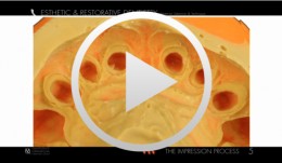 Esthetic and Restorative Dentistry - The Impression Process