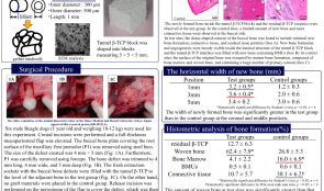 HISTOLOGICAL EVALUATION OF TUNNEL β-TRICALCIUM PHOSPHATE (β-TCP) BLOCKS FOR RIDGE PRESERVATION AFTER TOOTH EXTRACTION WITH BUCCAL BONE DEFICIENCY