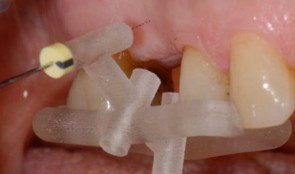 Analytical Methods: Volumetric Measurements 