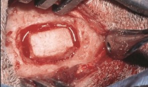 Sinus Floor Augmentation