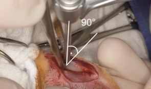 Compromised Bone Healing