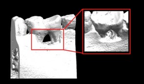 Periodontal Regeneration