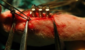 Osseointegration of Implants