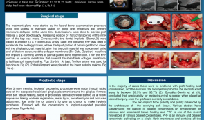 ACHIEVEMENT OF A HARMONIOUS SMILE VIA HARD AND SOFT TISSUE MANAGEMENTS ACCOMPANYING IMPLANT-SUPPORTED PROSTHESIS. A CASE REPORT.