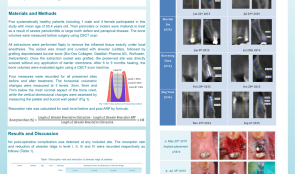 ALVEOLAR RIDGE PRESERVATION WITHOUT BARRIER MEMBRANE—A CASE SERIES