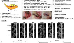 MICRO-TOMOGRAPHIC EVALUATION OF BONE MARROW MESENCHYMAL STEM CELLS AND BONE MARROW CONCENTRATE IN PERIODONTAL REGENERATION