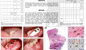 EXPANSION OF THE PERI-IMPLANT ATTACHED GINGIVA WITH A 3-D COLLAGEN MATRIX IN HEAD AND NECK CANCER PATIENTS—RESULTS FROM A PROSPECTIVE CLINICAL AND HISTOLOGICAL STUDY