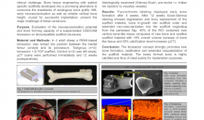 PERIOSTEAL PREFABRICATION OF VASCULARISED CAD/CAM BONE SCAFFOLDS