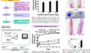 AZITHROMYCIN-RELEASING POLYMERIC MEMBRANES FOR GUIDED BONE REGENERATION (GBR)