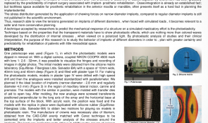 PHOTOELASTIC ANALYSIS OF OBLIQUE FORCES ON DIFFERENT IMPLANT DIAMETERS