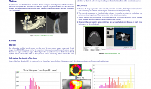 DEVELOPMENT OF A HELICOIDAL CT-BASED COMPUTER TOOL TO ESTIMATE BONE DENSITY AROUND DENTAL IMPLANTS