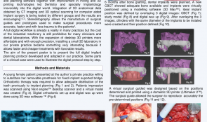 DIGITAL IMPLANT PLANNING WITH 3-D PRINTERS AND CBCTS IN GUIDED SURGERY AND BONE GRAFT PROCEDURES