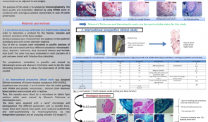 HISTOMORPHOMETRIC EVALUATION OF BONE QUALITY FOR PRESERVATION OF BONE VOLUME AFTER EXTRACTION USING PARTICULATE ALLOGRAFTS (DFDBA) AND PLATELET CONCENTRATES—AN INTERVENTIONAL PROSPECTIVE CLINICAL STUDY