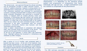 ORTHODONTIC BONE-STRETCHING TECHNIQUE FOR ANKYLOSED TEETH AND IMPLANT RELOCATION—PRELIMINARY RESULTS OF A CASE SERIES