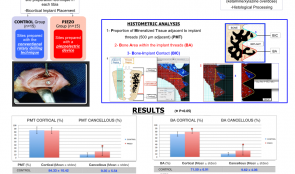 THE INFLUENCE OF PIEZOSURGERY ON BONE HEALING AROUND TITANIUM IMPLANTS – A HISTOLOGICAL STUDY IN RATS