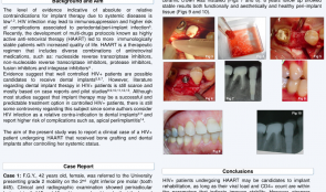 BONE AUGMENTATION IN HIV-POSITIVE PATIENTS ON HIGHLY ACTIVE ANTI-RETROVIRAL THERAPY—CASE REPORTS AND REVIEW OF THE LITERATURE