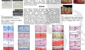 HISTOLOGICAL ANALYSIS OF DIFFERENT COLLAGEN MEMBRANES—PHYSIOLOGICAL OR FOREIGN BODY REACTION?