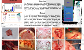 PLATELET-RICH FIBRIN—A PROMISING DRUG DELIVERY SYSTEM FOR TISSUE REGENERATION IN ORAL AND MAXILLOFACIAL SURGERY: PRECLINICAL AND CLINICAL STUDIES