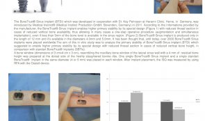 IN VITRO ASSESSMENT OF PRIMARY STABILITY OF BONE TRUST[TM] SINUS IMPLANT DESIGN—A PRELIMINARY STUDY