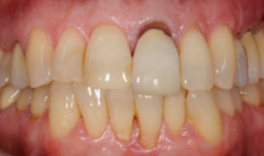 Comprehensive case in a woman