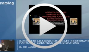 Immediate loading/immediate restoration - partially edentulous indications