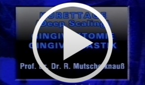 Kürrettage: Gingivektomie, Gingivoaplastik