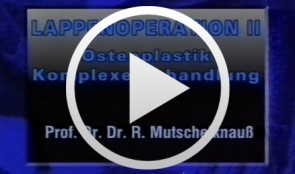 Lappenoperation II: Osteoplastik - Komplexe Behandlung