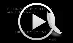 Esthetic and Restorative Dentistry - Esthetic Post Systems